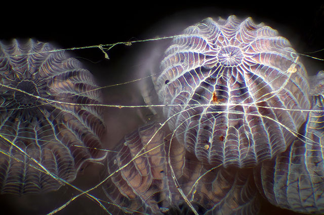 站在蜘蛛网上的蛾子卵（放大16倍） Photograph: Walter Piorkowski
